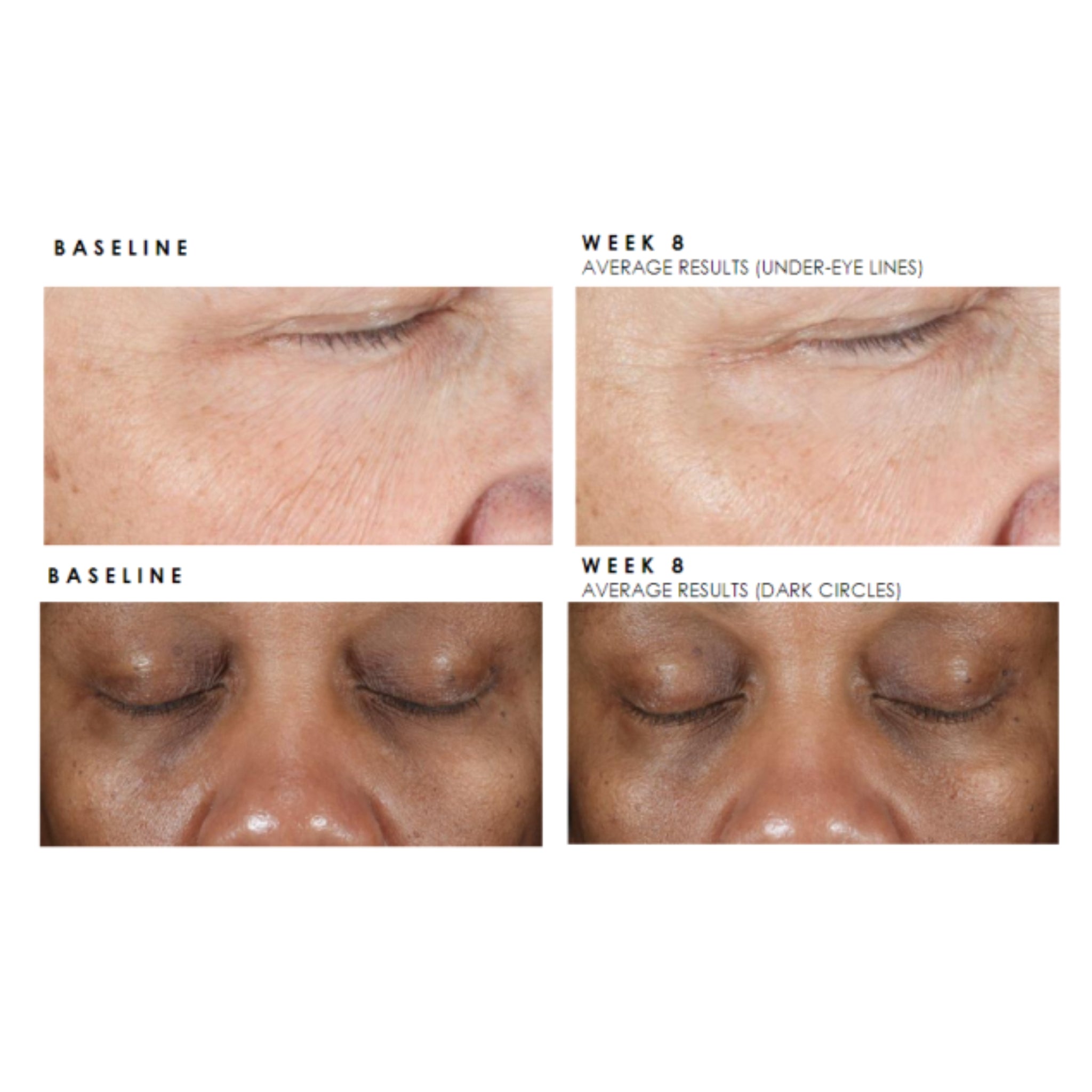 SkinCeuticals Age Advanced Eye