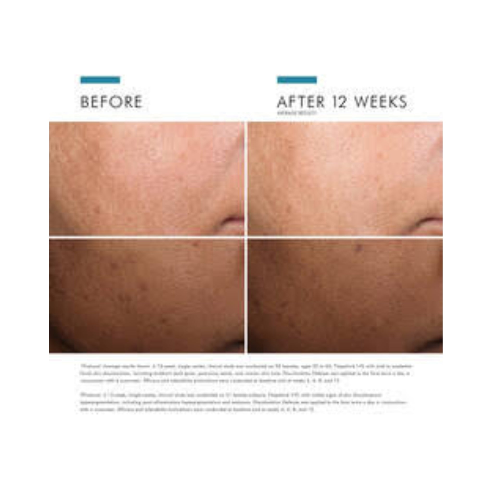 SkinCeuticals Discoloration Defense