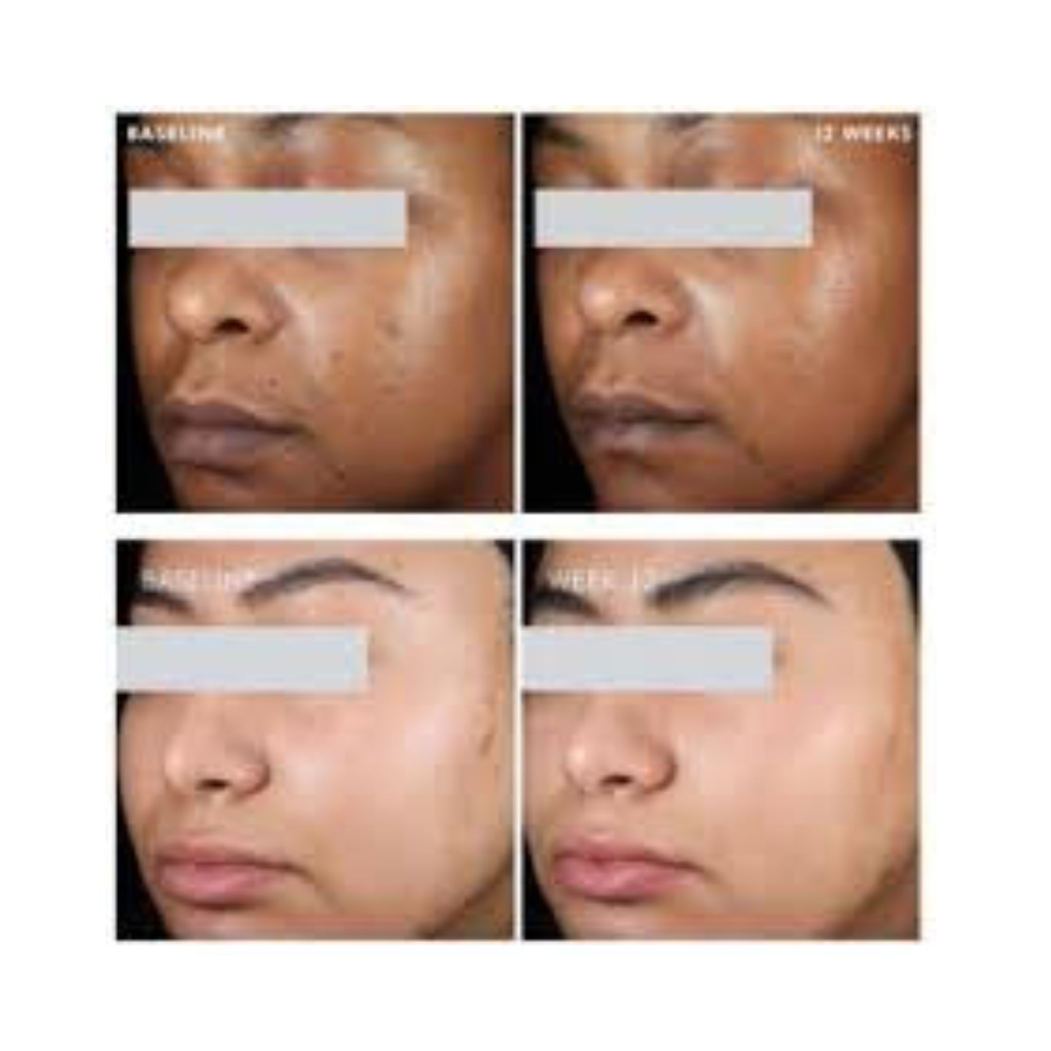 SkinCeuticals Phyto A+ Brightening Treatment