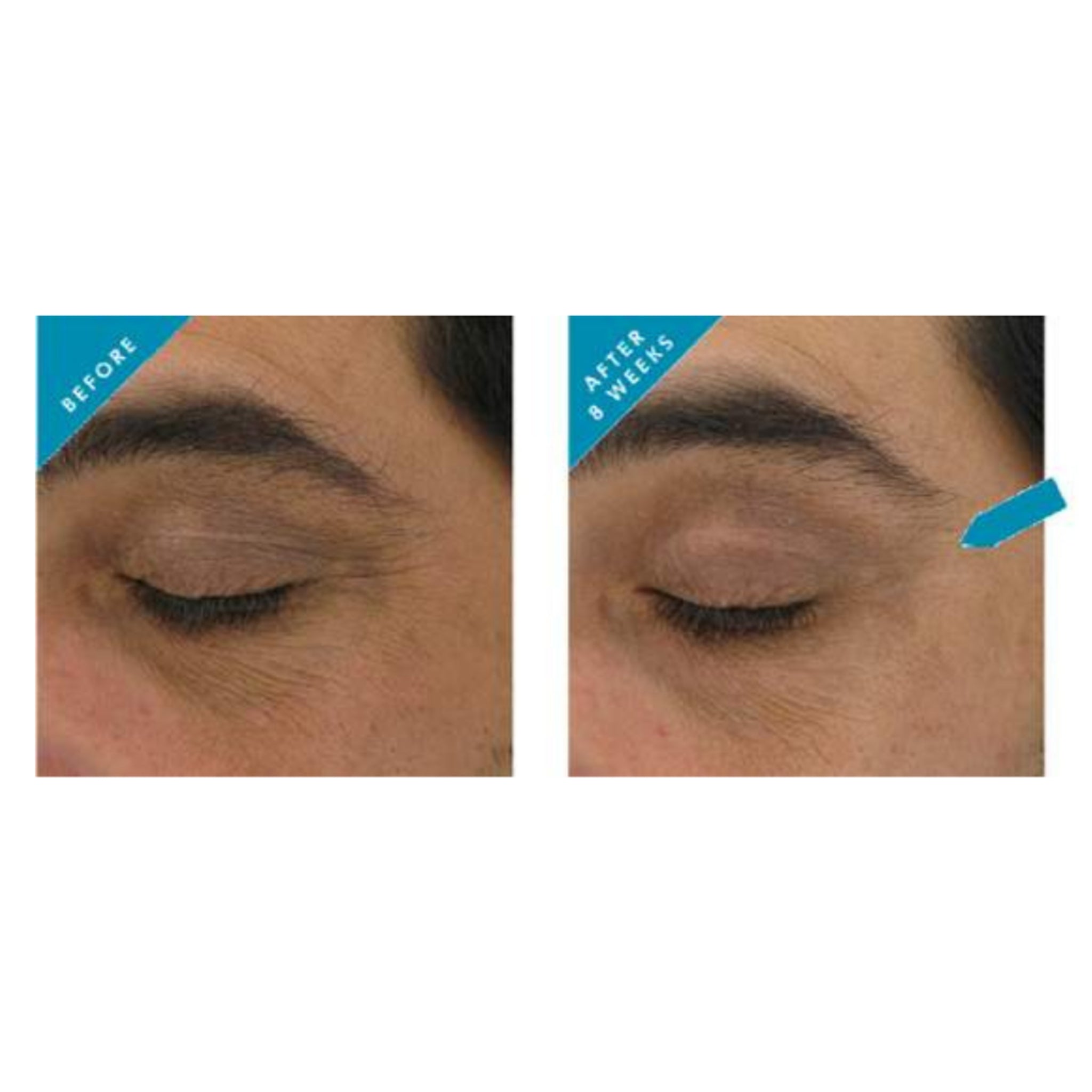 SkinCeuticals AOX Eye Gel