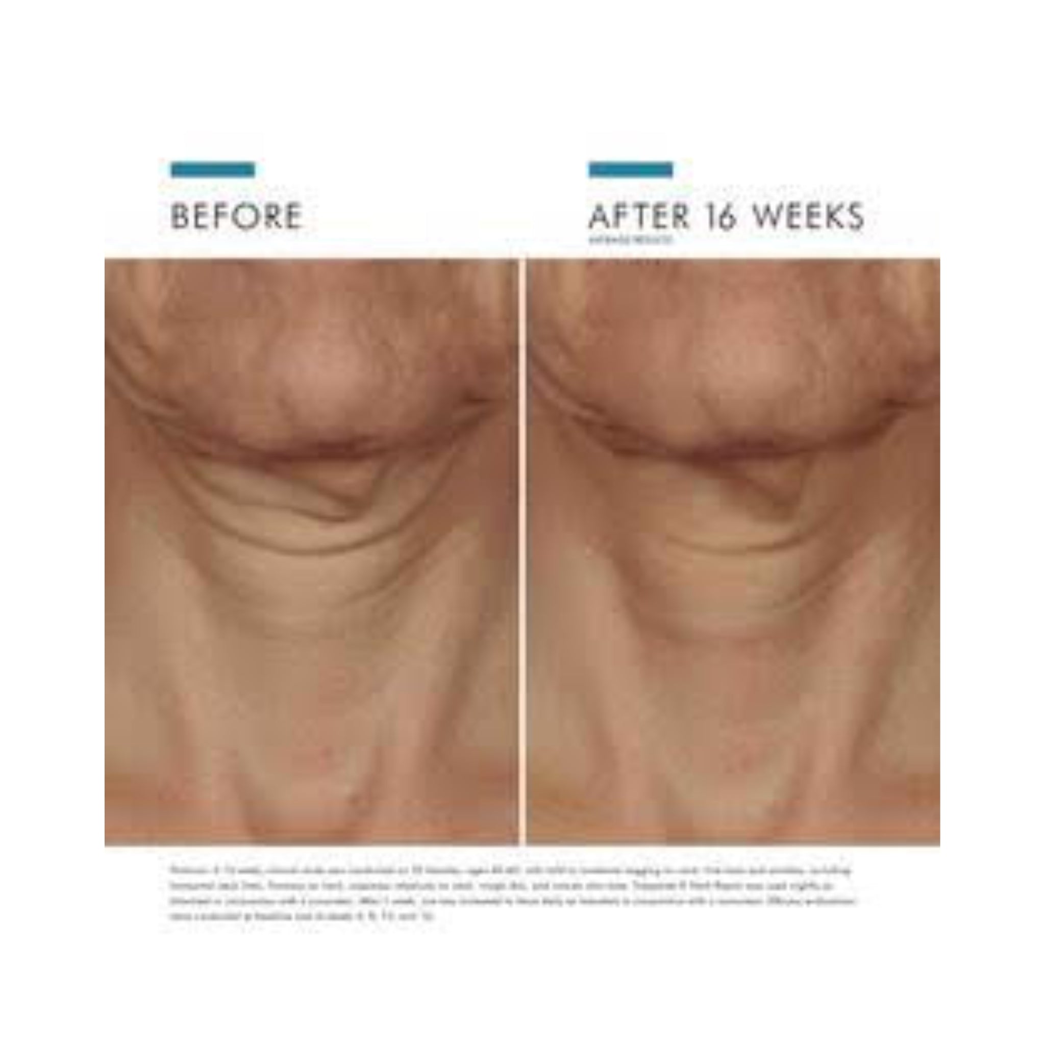 SkinCeuticals Tripeptide-R Neck Repair