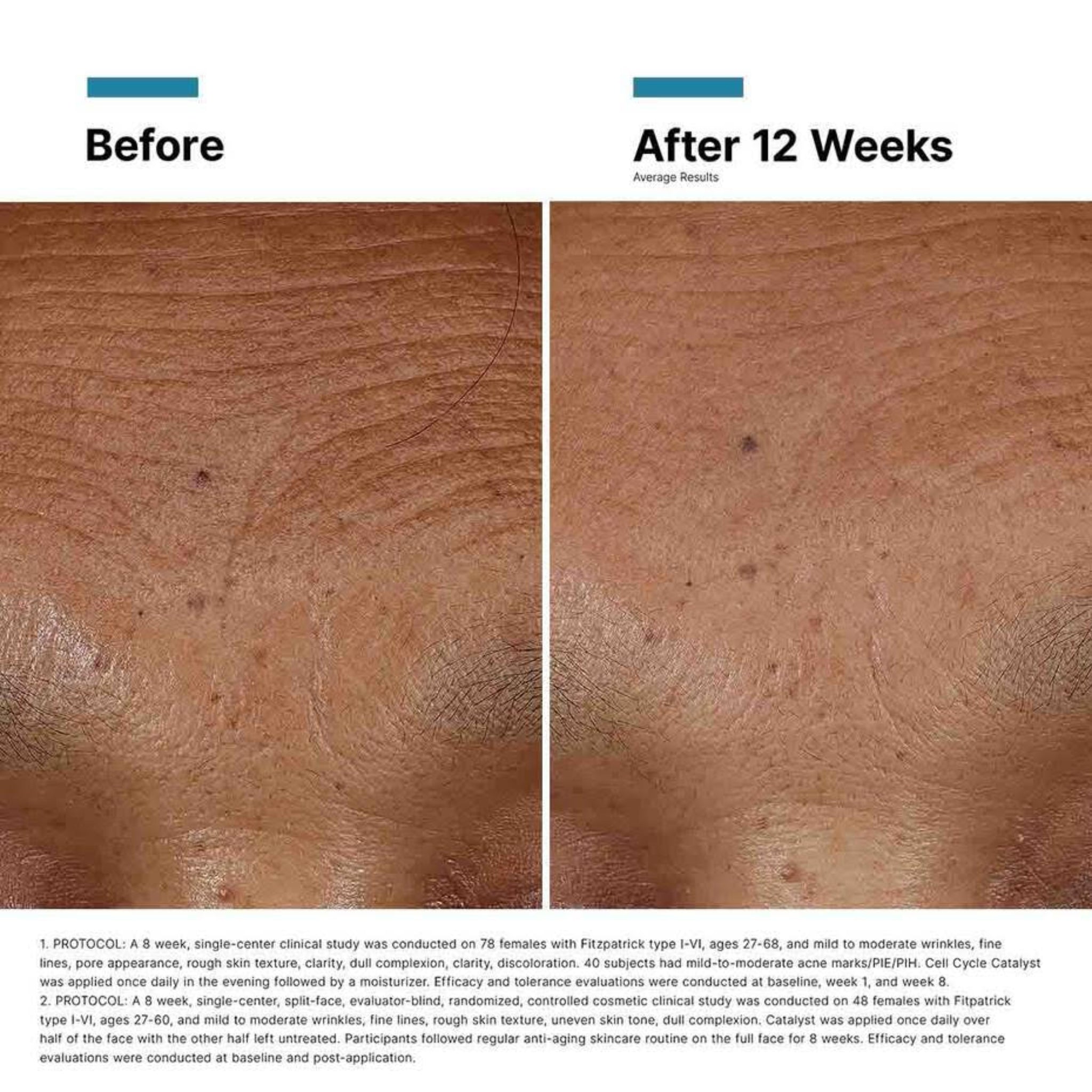 SkinCeuticals Hyaluronic Acid Iintensifier