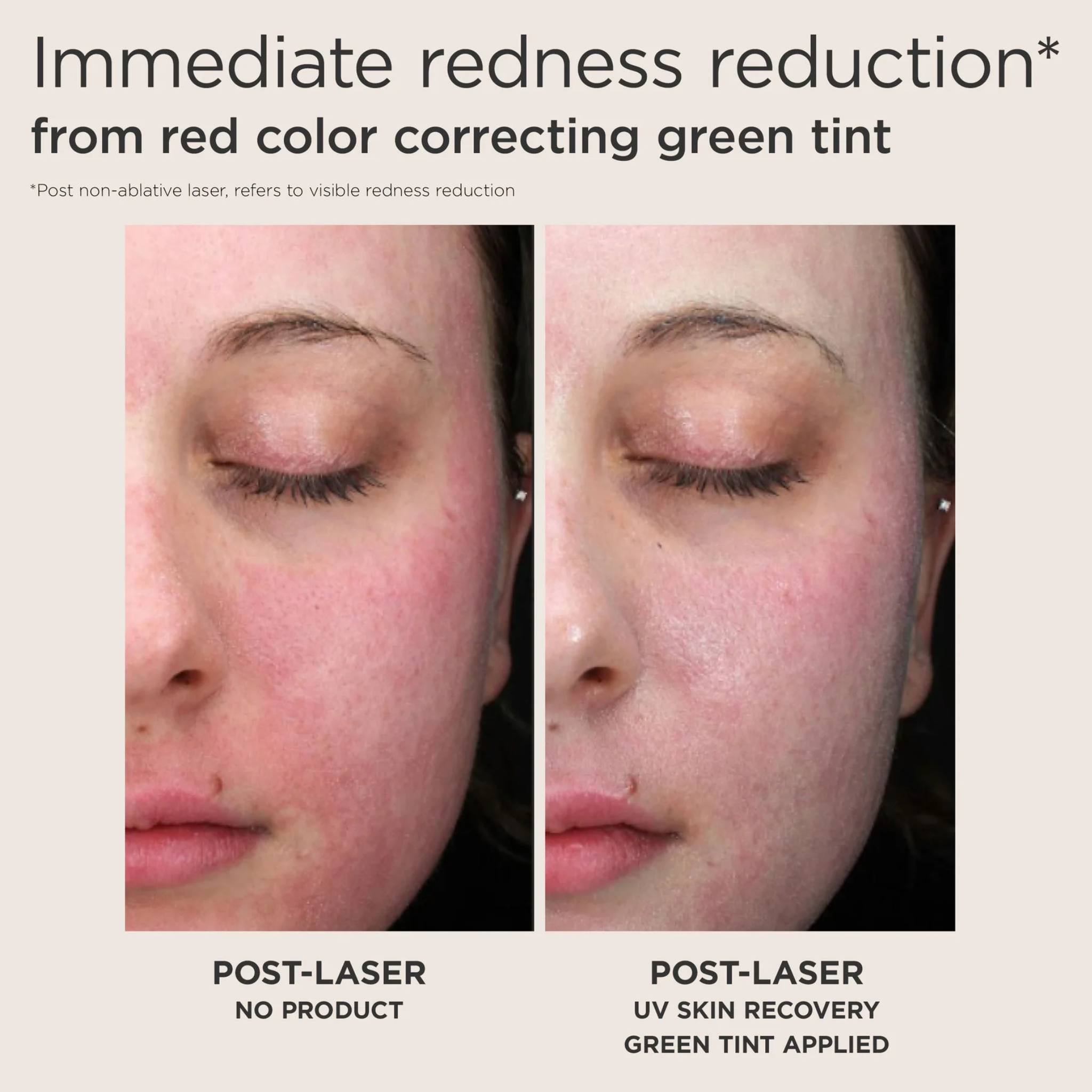 Elta UV Skin Recovery