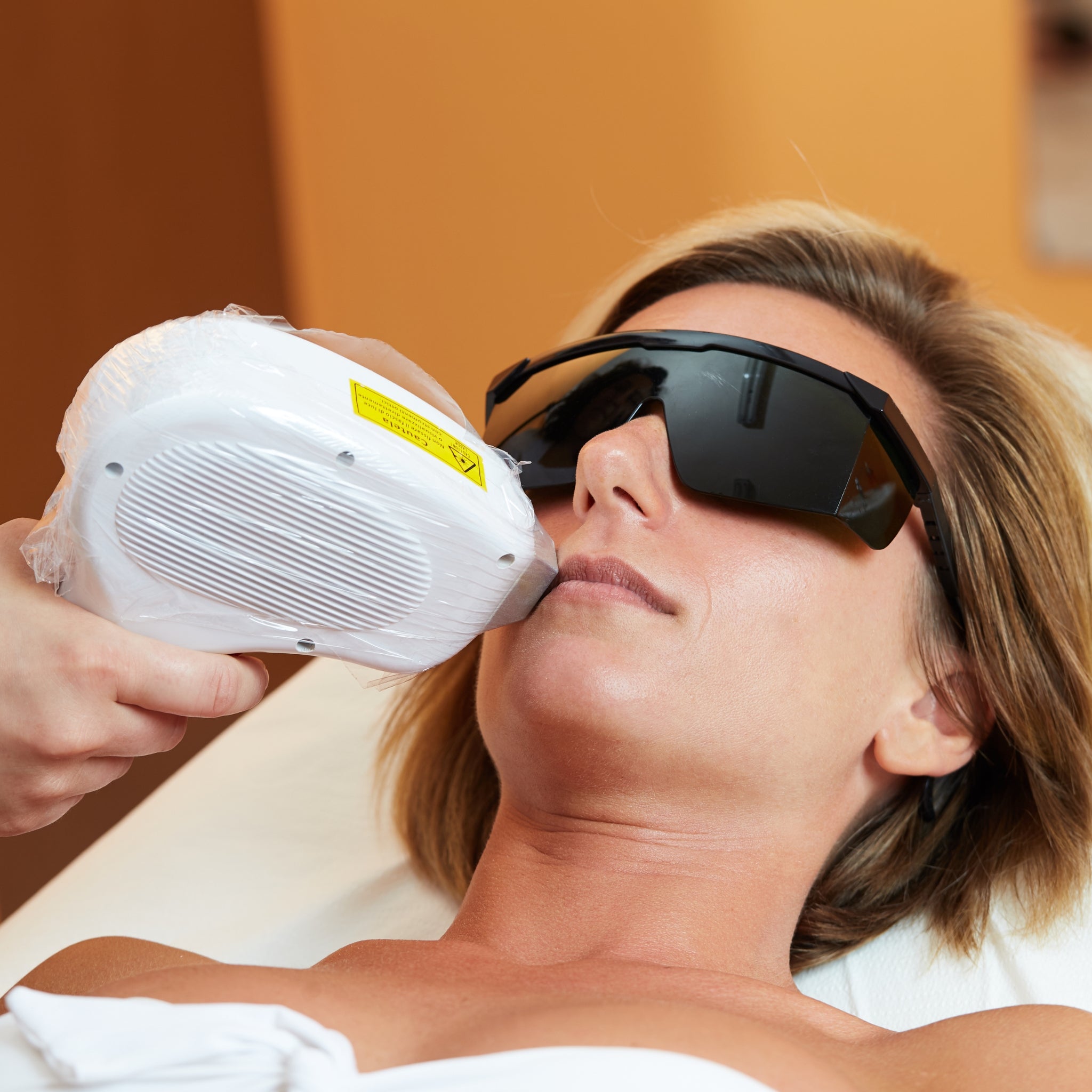 Intense Pulsed Light (IPL) Therapy