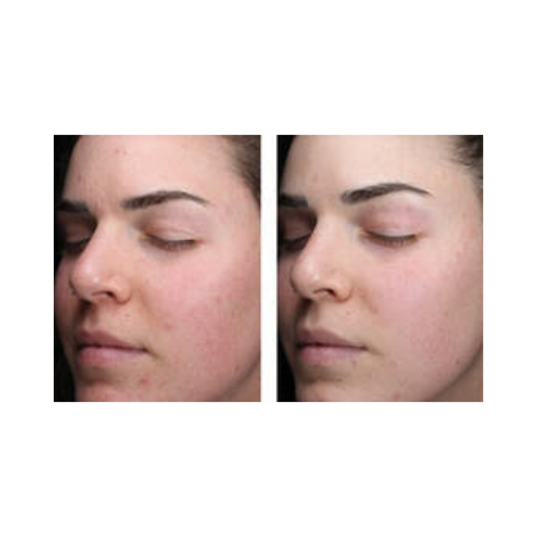 Skin Better Alpha Ret Clearing Serum