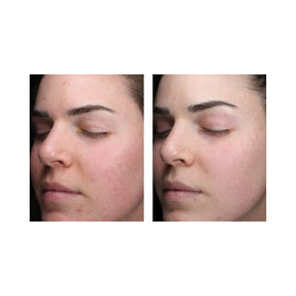 Skin Better Alpha Ret Clearing Serum