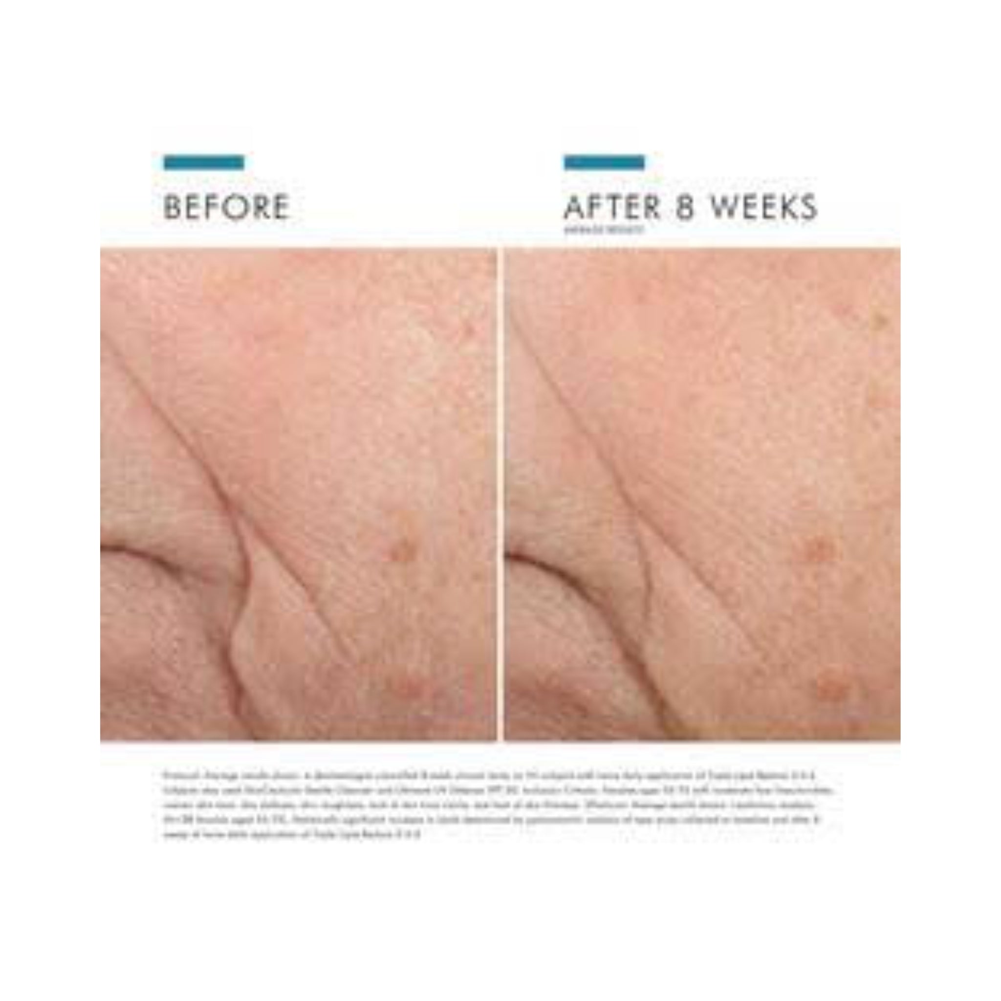 SkinCeuticals Triple Lipid
