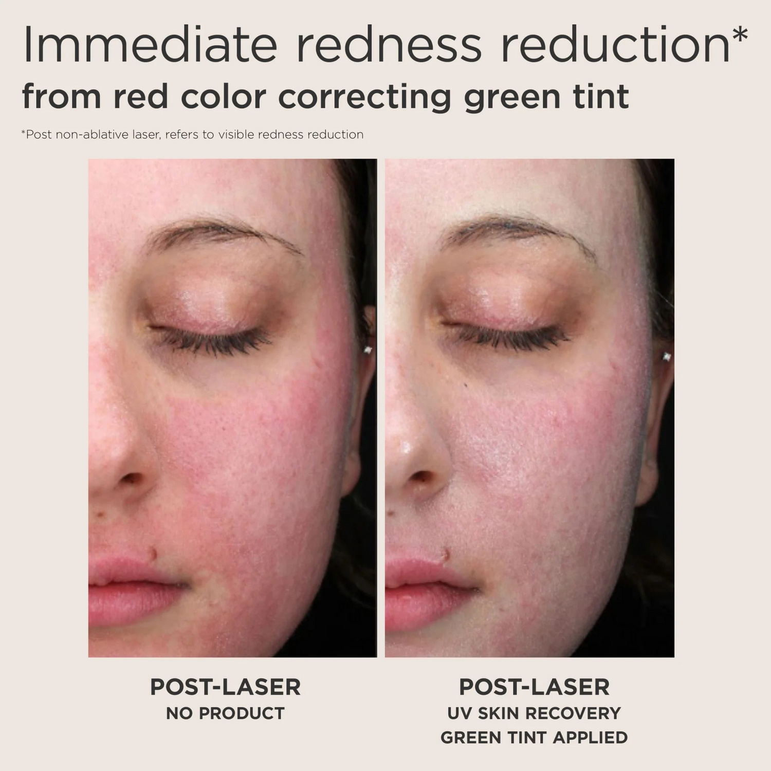 Elta UV Skin Recovery