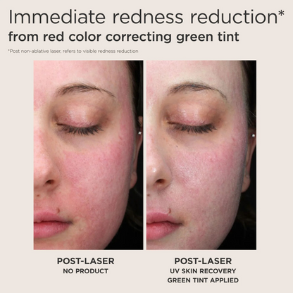 Elta UV Skin Recovery