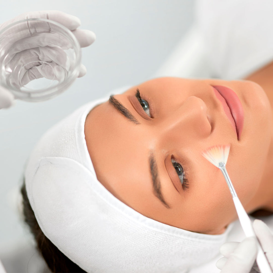 Chemical Peels